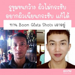 Review - รีวิว Boom Gluta Shots