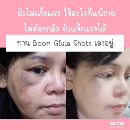 Review - รีวิว Boom Gluta Shots