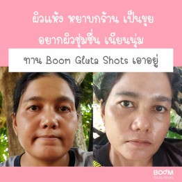 Review - รีวิว Boom Gluta Shots