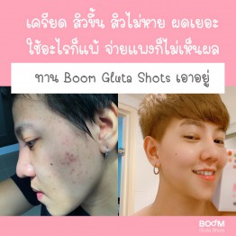 Review - รีวิว Boom Gluta Shots