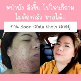 Review - รีวิว Boom Gluta Shots