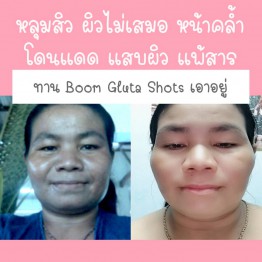 Review - รีวิว Boom Gluta Shots