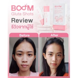 Review - รีวิว Boom Gluta Shots