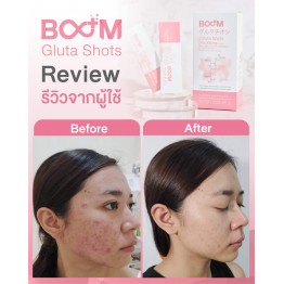 Review - รีวิว Boom Gluta Shots