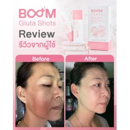 Review - รีวิว Boom Gluta Shots