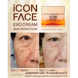 Review - รีวิว iCon Face Exo Cream