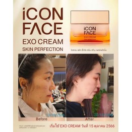 Review - รีวิว iCon Face Exo Cream