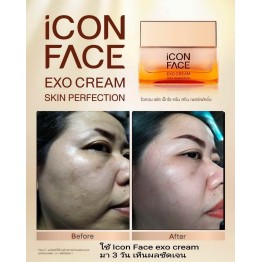 Review - รีวิว iCon Face Exo Cream