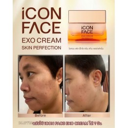 Review - รีวิว iCon Face Exo Cream