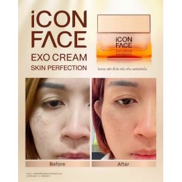 Review - รีวิว iCon Face Exo Cream