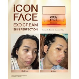 Review - รีวิว iCon Face Exo Cream