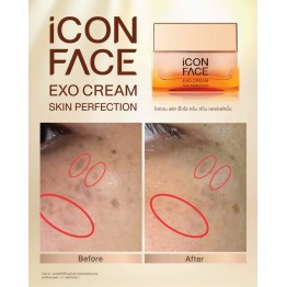 Review - รีวิว iCon Face Exo Cream