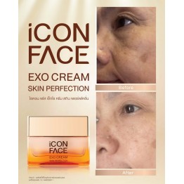 Review - รีวิว iCon Face Exo Cream