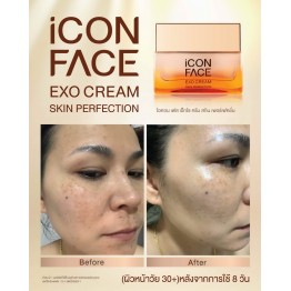 Review - รีวิว iCon Face Exo Cream