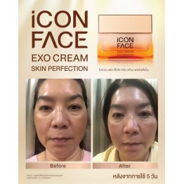 Review - รีวิว iCon Face Exo Cream