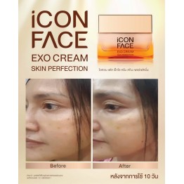 Review - รีวิว iCon Face Exo Cream