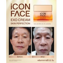 Review - รีวิว iCon Face Exo Cream