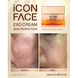 Review - รีวิว iCon Face Exo Cream