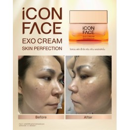 Review - รีวิว iCon Face Exo Cream