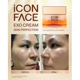 Review - รีวิว iCon Face Exo Cream