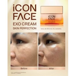 Review - รีวิว iCon Face Exo Cream