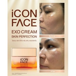 Review - รีวิว iCon Face Exo Cream