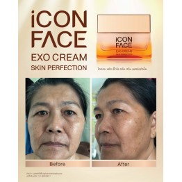 Review - รีวิว iCon Face Exo Cream