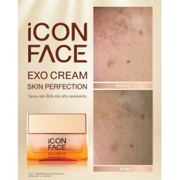 Review - รีวิว iCon Face Exo Cream