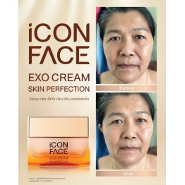 Review - รีวิว iCon Face Exo Cream