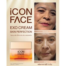 Review - รีวิว iCon Face Exo Cream