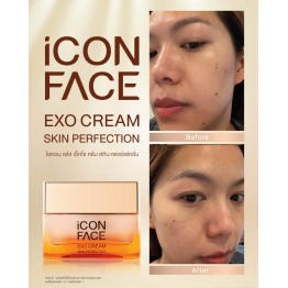 Review - รีวิว iCon Face Exo Cream