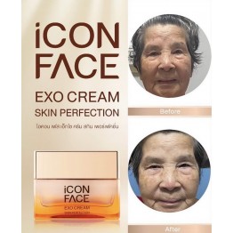 Review - รีวิว iCon Face Exo Cream