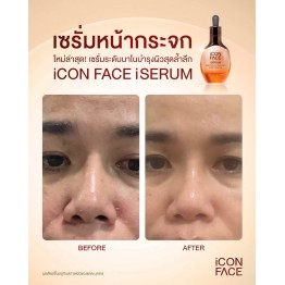 Review - รีวิว iCon Face iSerum