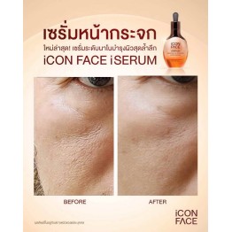 Review - รีวิว iCon Face iSerum