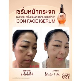 Review - รีวิว iCon Face iSerum