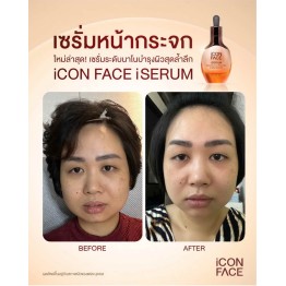 Review - รีวิว iCon Face iSerum