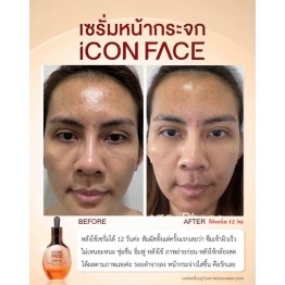 Review - รีวิว iCon Face iSerum