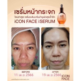 Review - รีวิว iCon Face iSerum