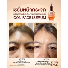 Review - รีวิว iCon Face iSerum