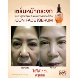 Review - รีวิว iCon Face iSerum