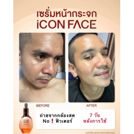 Review - รีวิว iCon Face iSerum