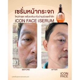 Review - รีวิว iCon Face iSerum