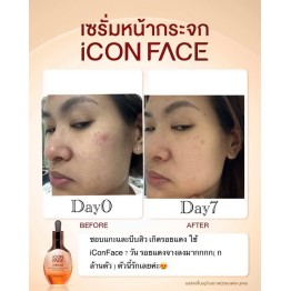 Review - รีวิว iCon Face iSerum