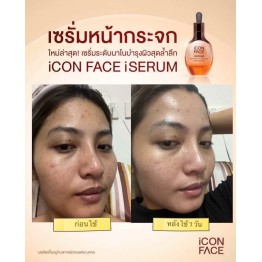 Review - รีวิว iCon Face iSerum