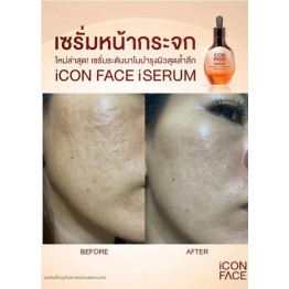 Review - รีวิว iCon Face iSerum