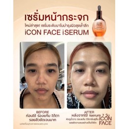 Review - รีวิว iCon Face iSerum