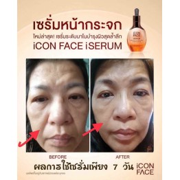 Review - รีวิว iCon Face iSerum