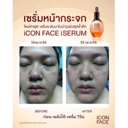 Review - รีวิว iCon Face iSerum