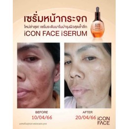 Review - รีวิว iCon Face iSerum