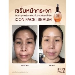 Review - รีวิว iCon Face iSerum